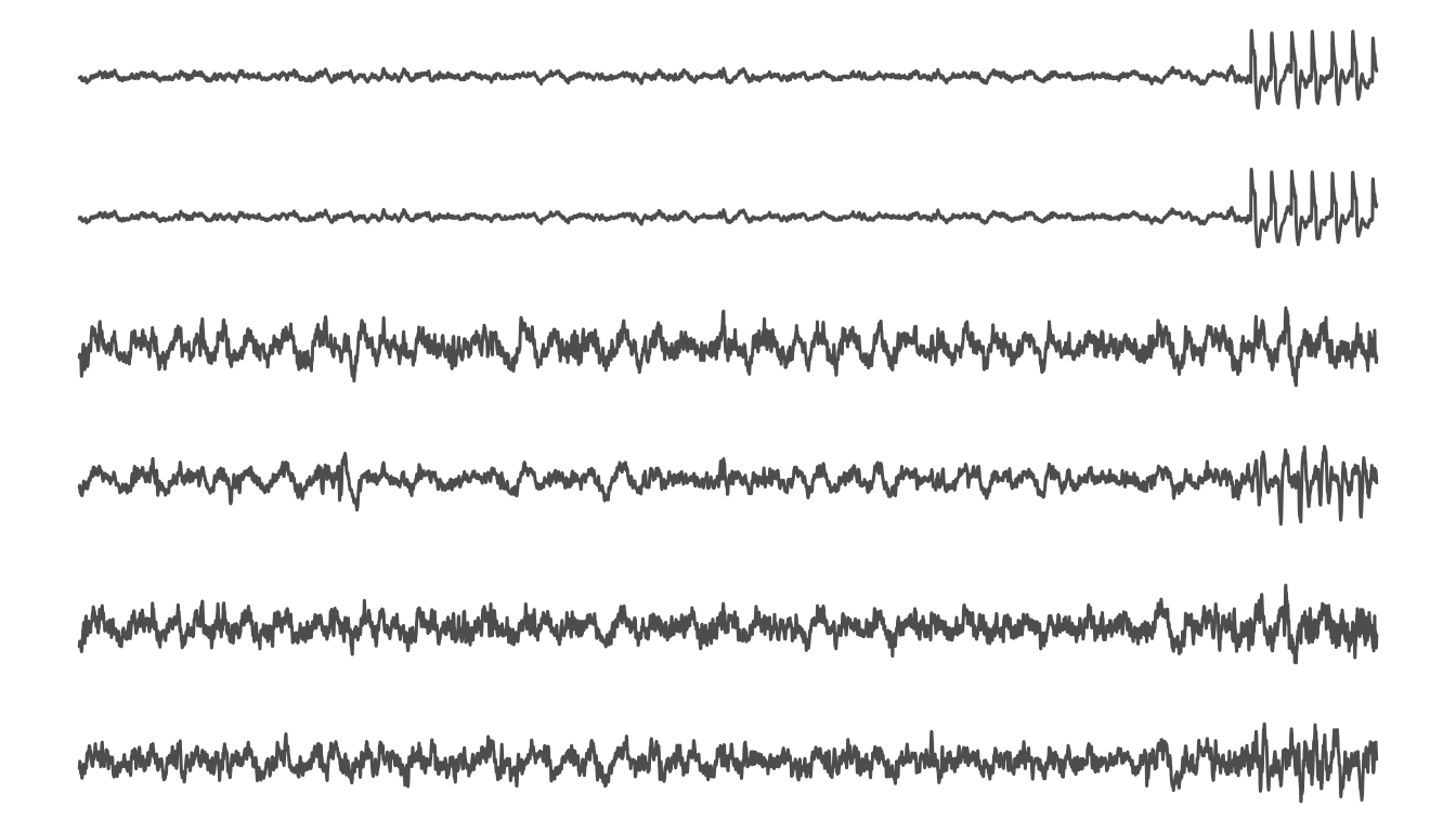 8 second window of EEG inclduing the start appplication of a laser stimulus.